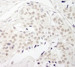 Protein Phosphatase 1 beta Antibody, Novus Biologicals 0.1mL; Unlabeled:Antibodies,